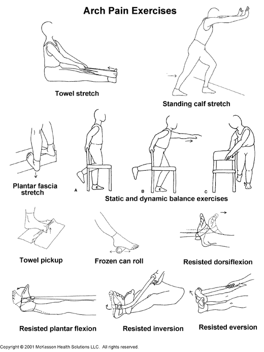 Arch Pain Exercises 