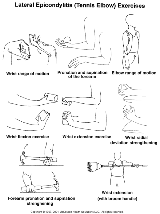 tennis elbow exercises