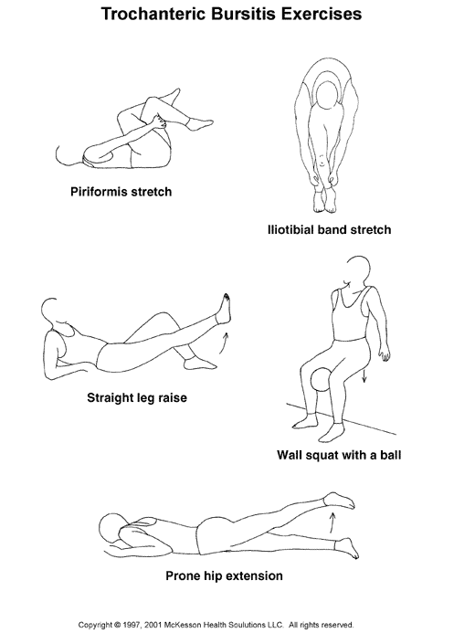 trochanteric bursitis exercises